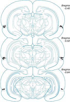 Infusing zeta inhibitory peptide into the perirhinal cortex of rats abolishes long-term object recognition memory without affecting novel object location recognition